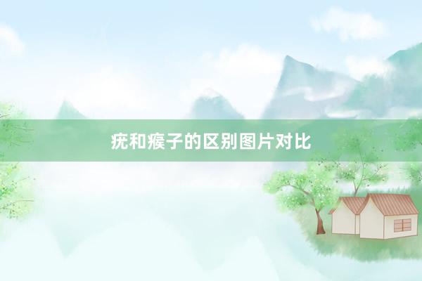 疣和瘊子的区别图片对比